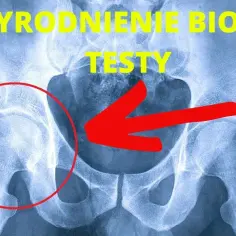 Odkryj tajniki Totalna Biologia Biodro i zwalczyj ból biodra efektywnie